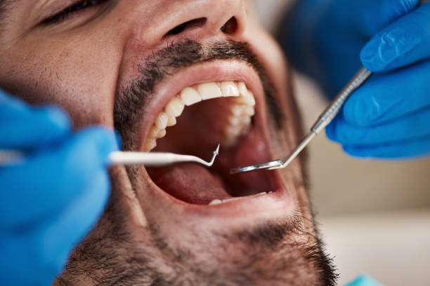 Best Emergency Treatment for Toothache in Milford, DE